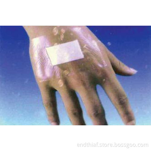 OEM / ODM Elastic Non-Woven Wound Plaster Dressing, Medical